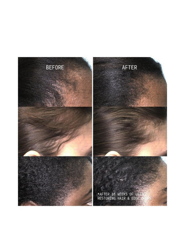 Cecred - Restoring Hair & Edge Drops - Daily Peptide Serum for Fuller-Looking Hair, Supports Hairline & Scalp Health, Strengthens Roots, Size:(1.7 fl oz)