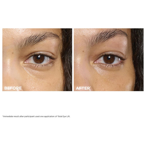Clarins NEW Total Eye Lift | Anti Aging Eye Cream | Targets Wrinkles, Crow's Feet, Dark Circles and Puffiness For a Visible Eye Lift in 30 Seconds