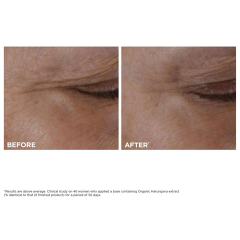 Clarins NEW Total Eye Lift | Anti Aging Eye Cream | Targets Wrinkles, Crow's Feet, Dark Circles and Puffiness For a Visible Eye Lift in 30 Seconds