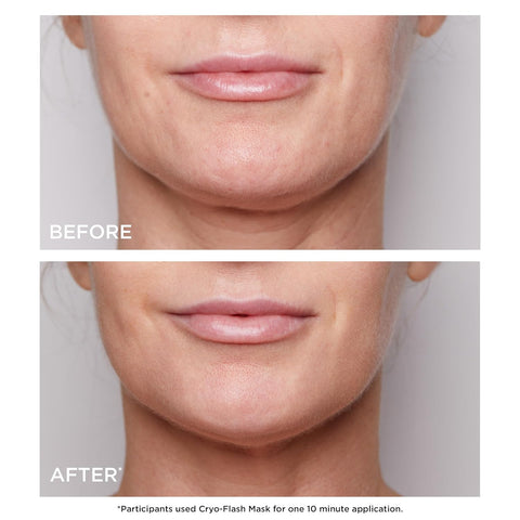 Clarins Cryo-Flash Face Mask | Visible Lift Effect in 10 Minutes* | Visibly Minimizes Pores | Boosts Radiance | Pro Like Results | All Skin Types