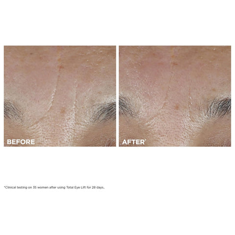 Clarins NEW Total Eye Lift | Anti Aging Eye Cream | Targets Wrinkles, Crow's Feet, Dark Circles and Puffiness For a Visible Eye Lift in 30 Seconds