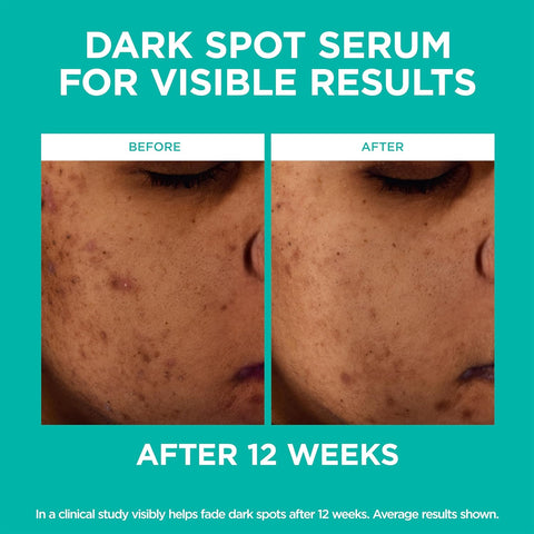 L'Oreal Paris Bright Reveal Niacinamide Dark Spot Serum + Broad-Spectrum SPF 50 Daily UV Lotion + Moisturizer Samples